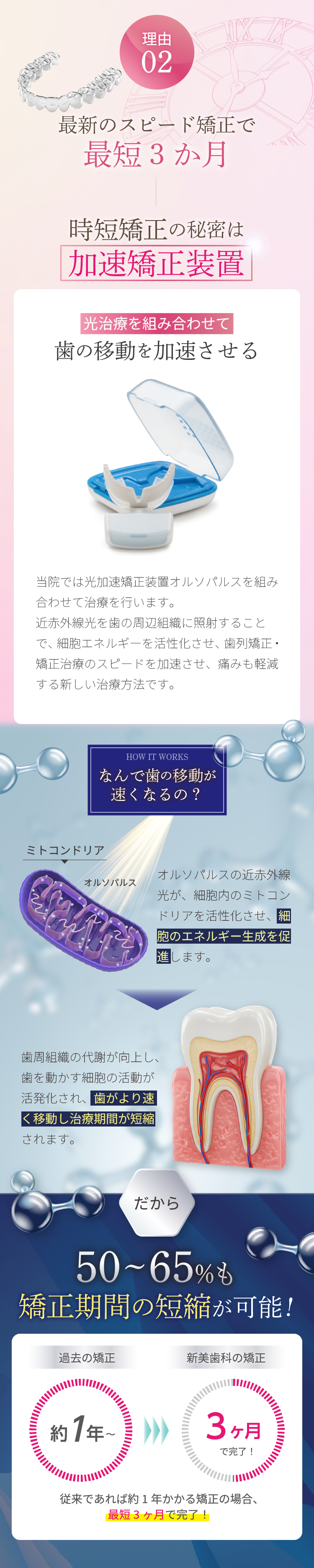 理由2 - 最新のスピード矯正で最短bン3か月 - 時短矯正の秘密は加速矯正装置 | 新美歯科