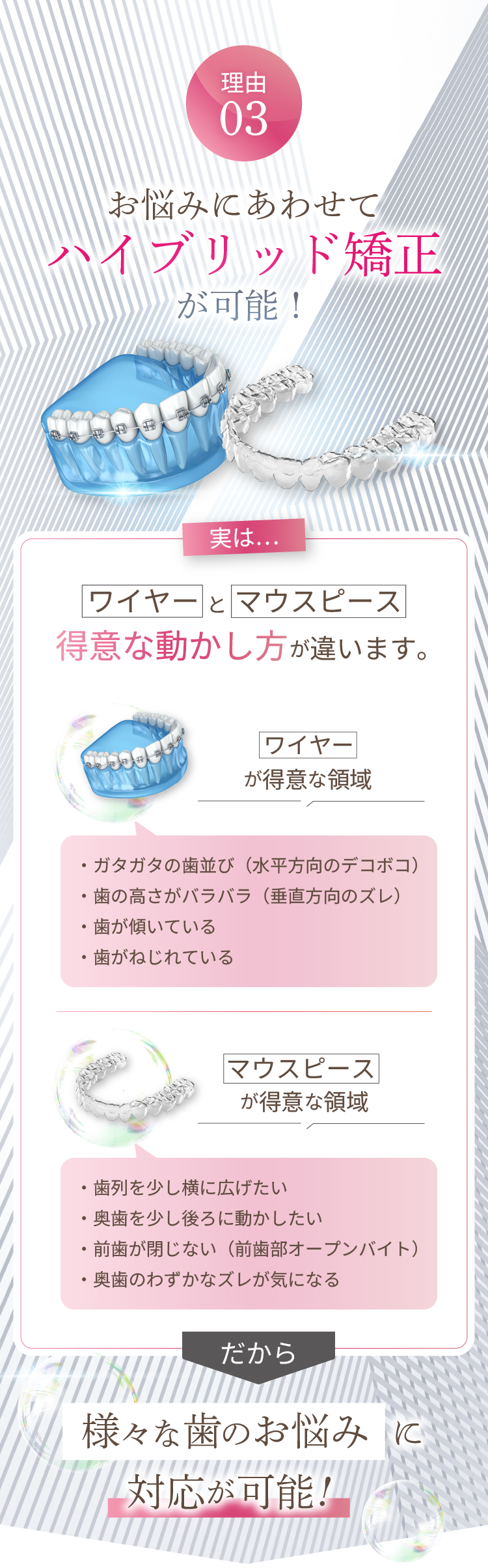 理由3 - お悩みにあわせてハイブリッド矯正が可能！ | 新美歯科