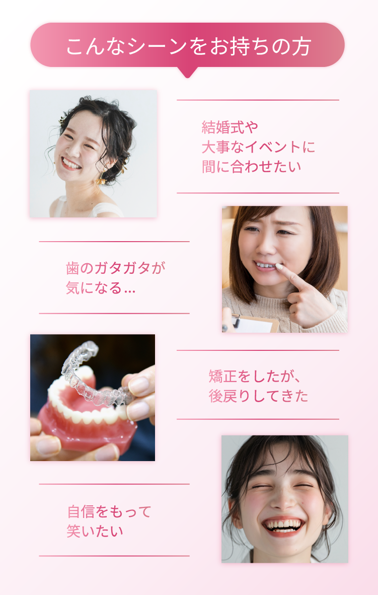 こんなシーンをお持ちの方 - 結婚式や大事なイベントに間に合わせたい - 歯のガタガタが気になる・・・ - 矯正をしたが、後戻りしてきた - 自身をもって笑いたい - | 新美歯科