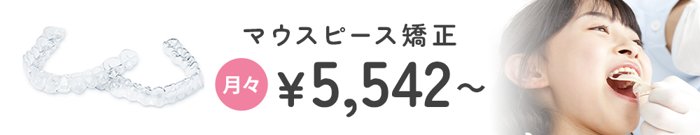 マウスピース矯正