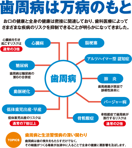 歯周病は万病のもと